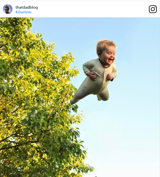 Wil Lawrences egy tündéri Down-szindrómás kisfiú