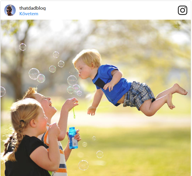 Wil Lawrences egy tündéri Down-szindrómás kisfiú